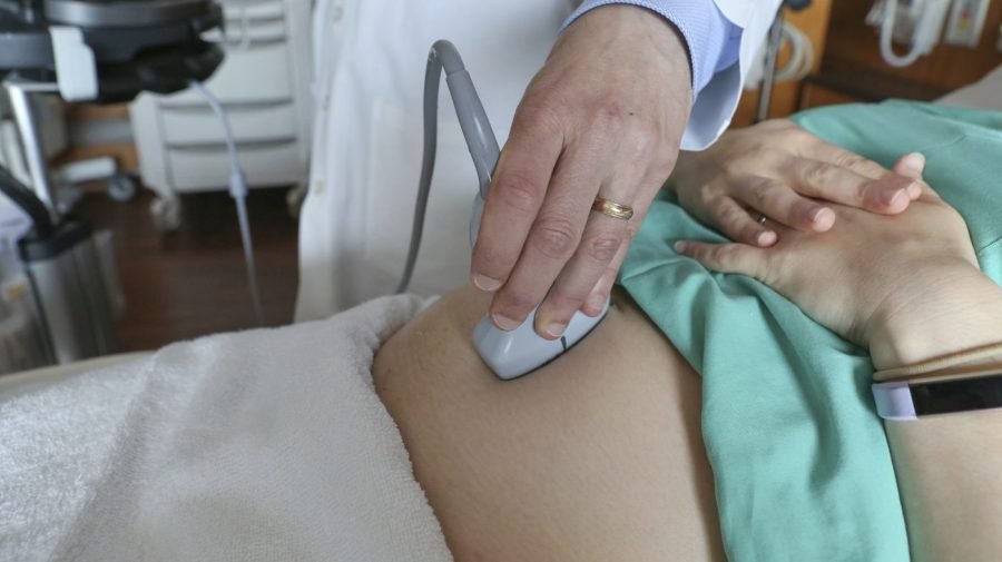 Pregnancy linked to accelerated biological aging, study finds