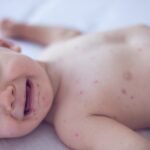 Does RFK Jr. care that babies will needlessly die under his vaccination policies?