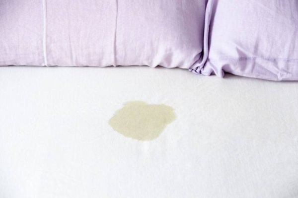 What It Actually Means When a Dog Leaks Urine While They Sleep (It’s Serious)