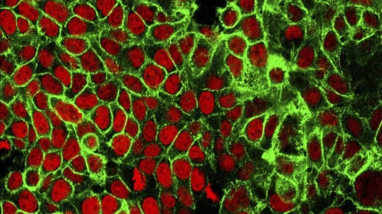 'Treatable, but not curable': Mother warns others after stage 4 colon cancer diagnosis at 33