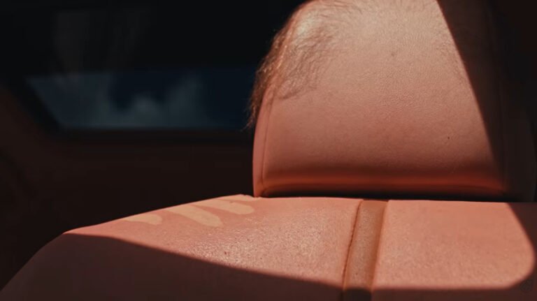 Australian Company Sheds Light On In-Car Sun Exposure By Reupholstering A Camry With Human-Like Skin That 'Burns' In Sunlight