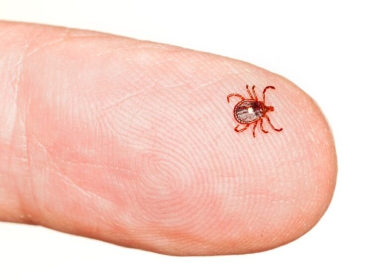 Tick bites keep sending Americans to emergency departments: When should you seek care?