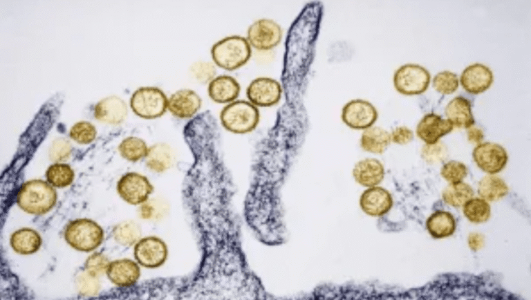 Fatal Colorado hantavirus case not linked to cruise ship, officials say