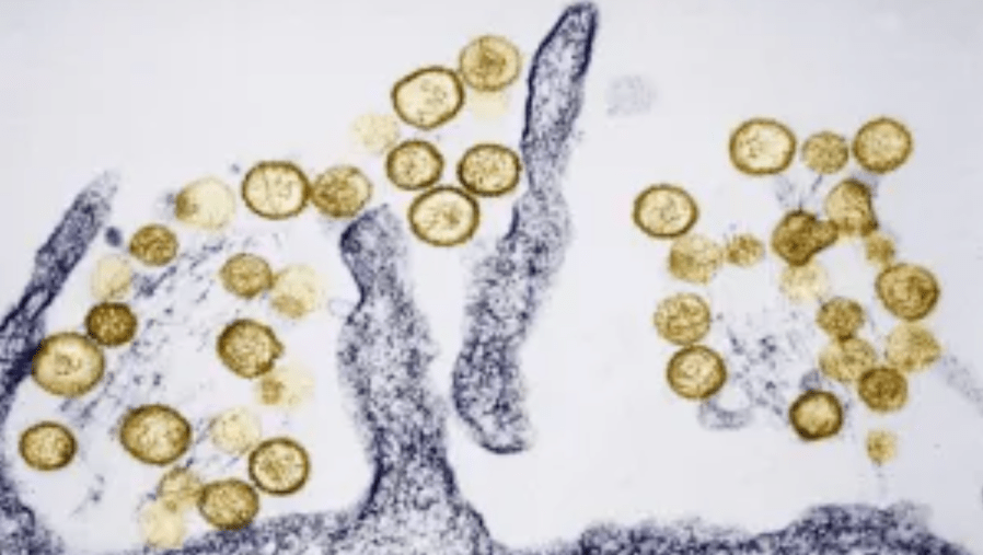 Fatal Colorado hantavirus case not linked to cruise ship, officials say