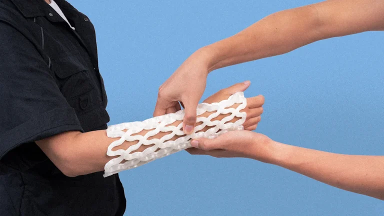 This 3D-printed cast shapes to your arm—and makes healing a broken bone more comfortable