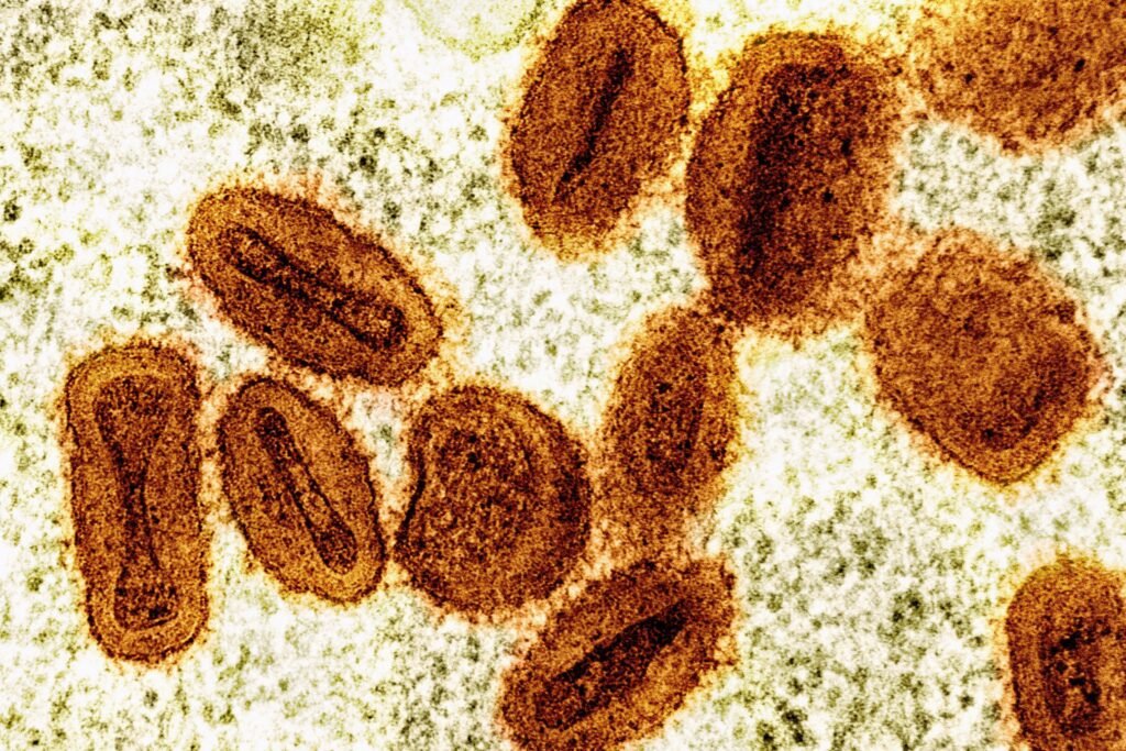 2 researchers charged with smuggling mpox into the US