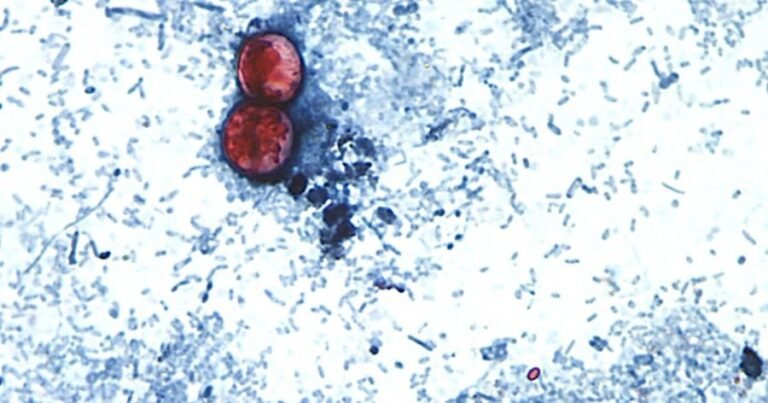 Another cyclospora outbreak not linked to lettuce under investigation: FDA