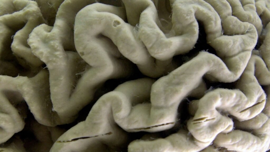 High Alzheimer’s risk in healthy adults may be identified with this blood test