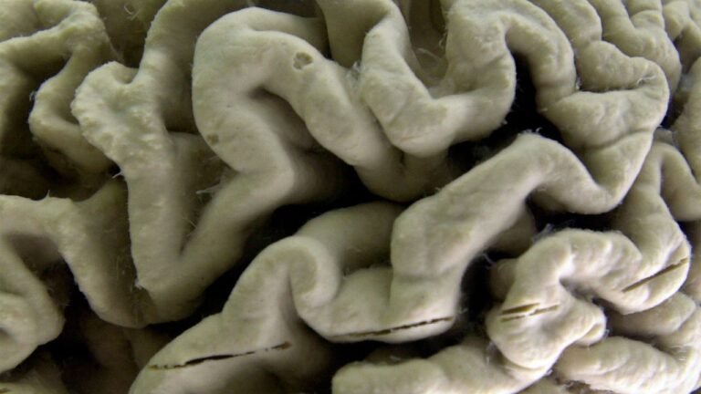 High Alzheimer’s risk in healthy adults may be identified with this blood test