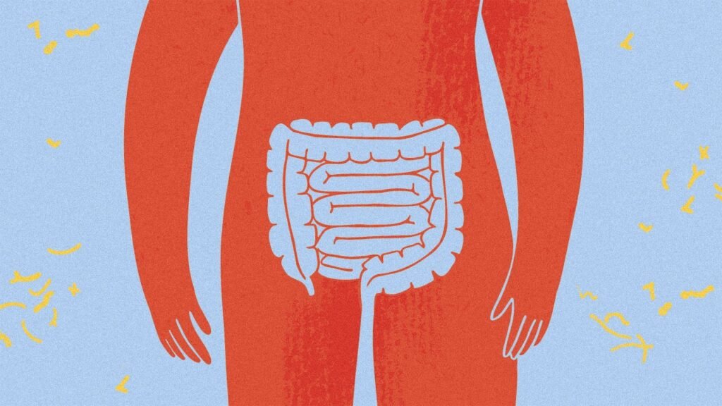 Why are healthy young adults getting colon cancer? Researchers may finally have a lead