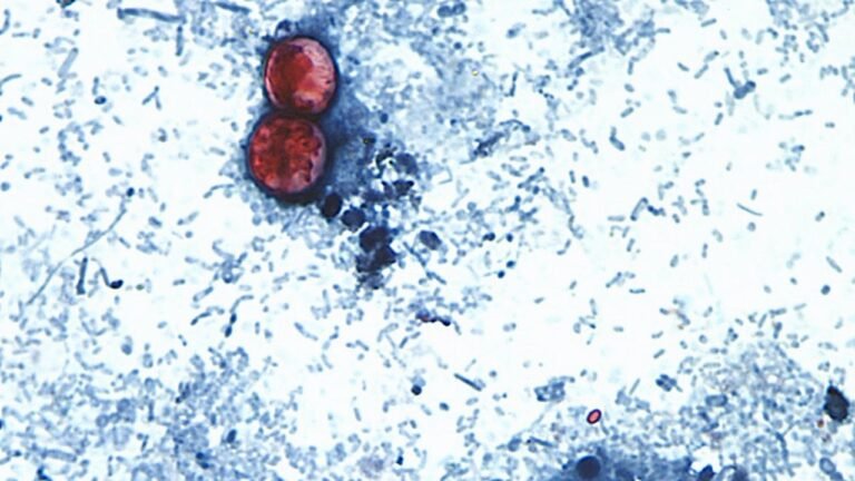 Michigan reports first 2 deaths linked to the cyclospora outbreak