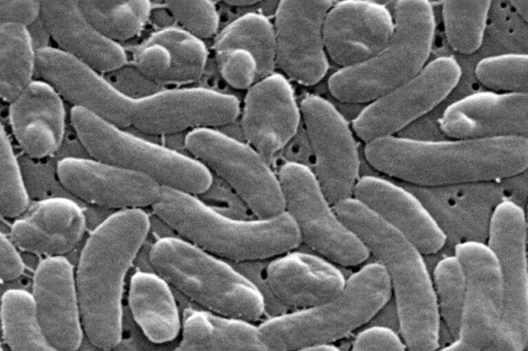 Death toll from flesh-eating bacteria rises: These are the Vibrio warning signs to watch for