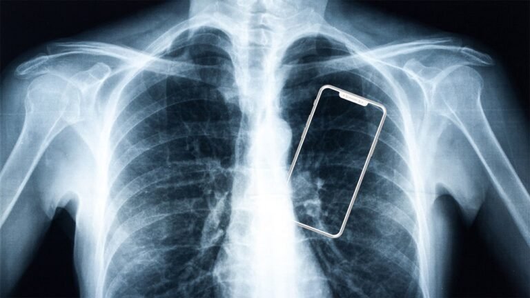 Your smartphone is changing your body. Doctors say most people don’t know it’s happening