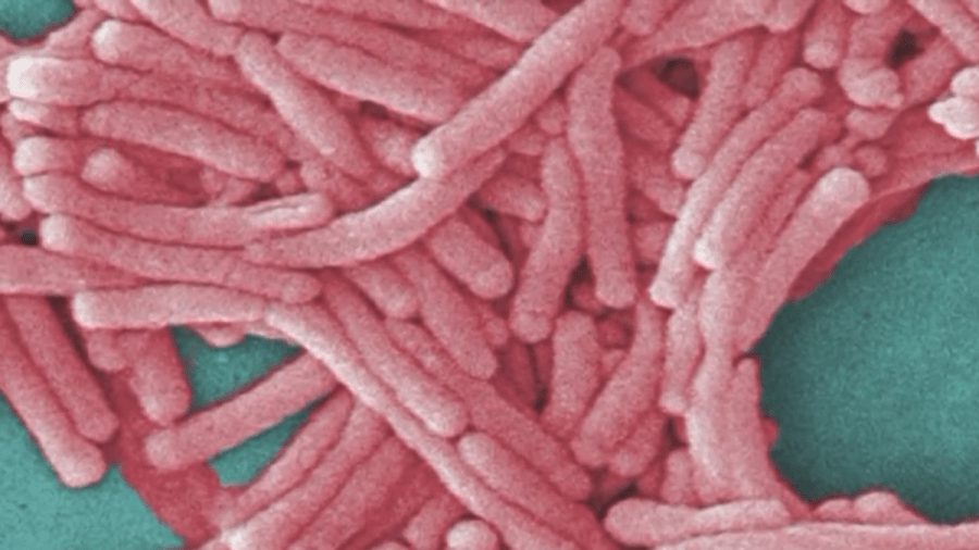 Second death confirmed in Bronx Legionnaires' disease cluster