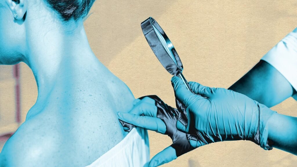 Skin cancer detection tools powered by AI are improving. Not everyone is benefitting