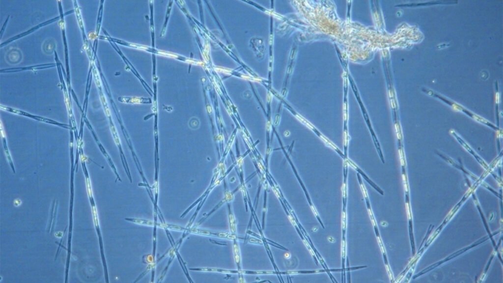 Wastewater Can Take Harmful Algal Blooms from Bad to Worse