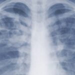 Pneumonic plague: What is it and how dangerous can it be?