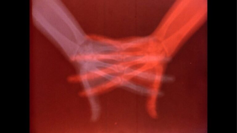 Medical Imaging and Art Meet in the Exhibition “Overexposed”